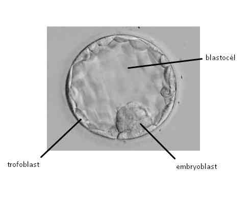 blastocysta 1